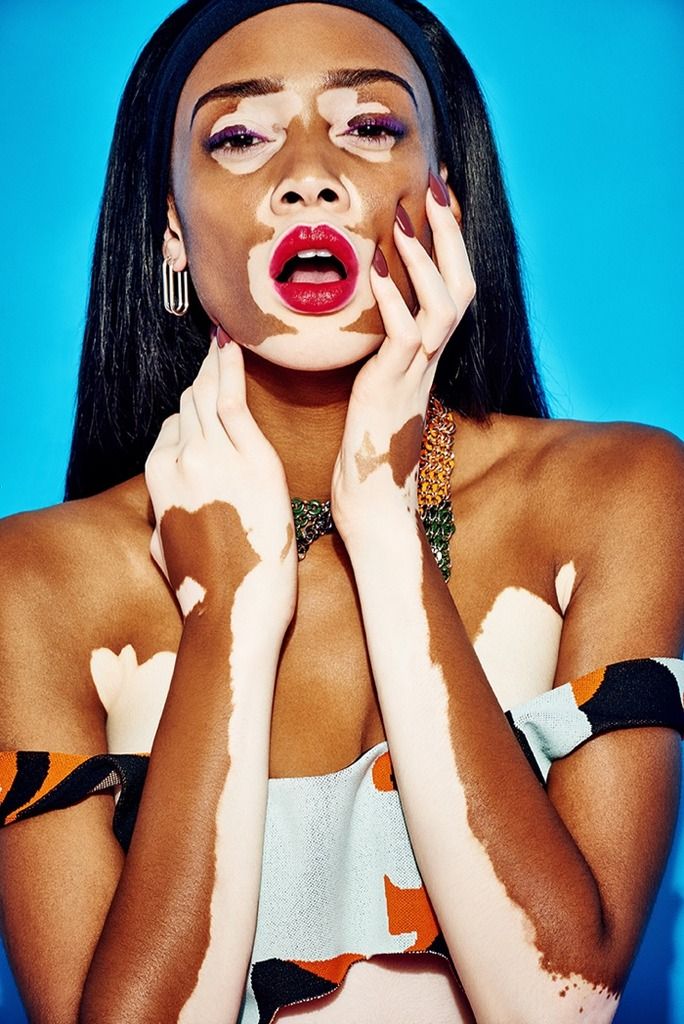 топ модель по американски винни харлоу какой сезон. Winnie Harlow GQ Portugal Pictures 2015 05 zpskw5jprlu. топ модель по американски винни харлоу какой сезон фото. топ модель по американски винни харлоу какой сезон-Winnie Harlow GQ Portugal Pictures 2015 05 zpskw5jprlu. картинка топ модель по американски винни харлоу какой сезон. картинка Winnie Harlow GQ Portugal Pictures 2015 05 zpskw5jprlu