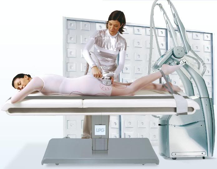 Endermologie Endermologie